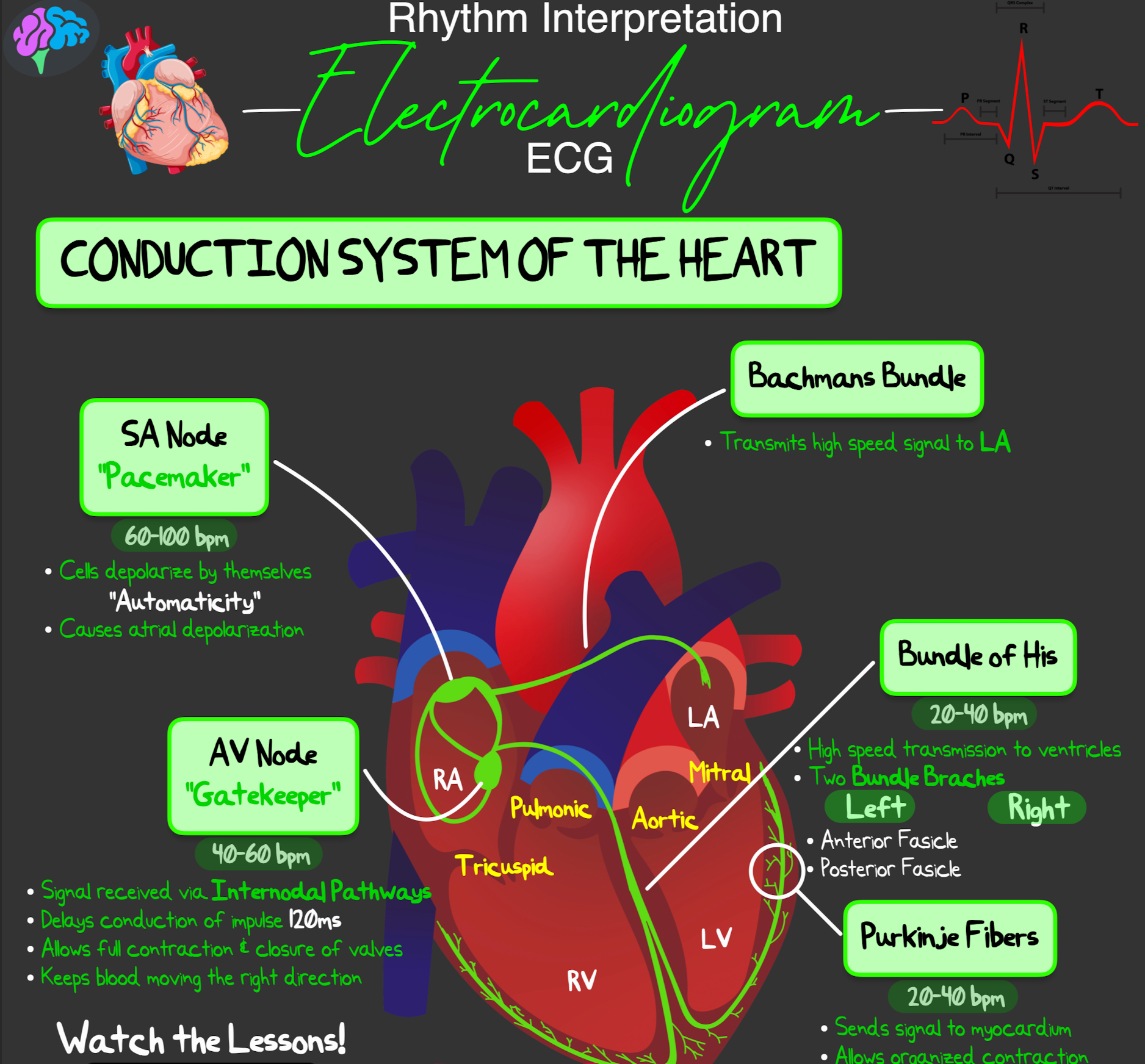 Rhythm Interpretation Notes (PDF) – ICU Advantage