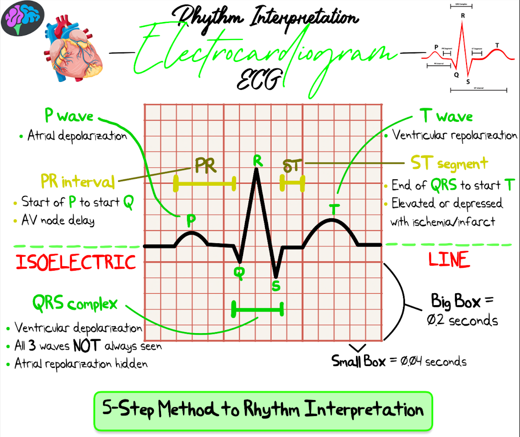 Heart Rythim Chart How To Read A Heart Rhythm Chart