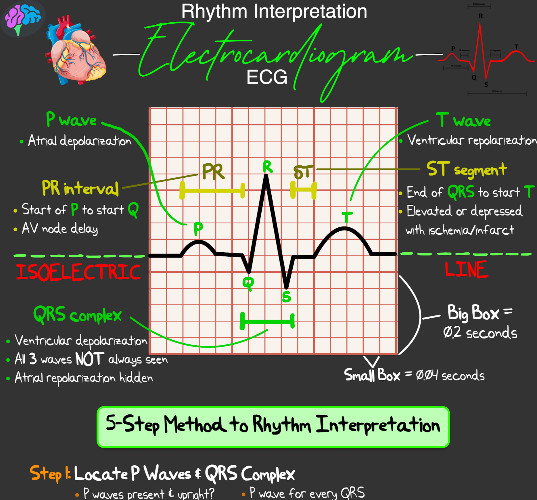 Rhythm Interpretation Notes (PDF) – ICU Advantage
