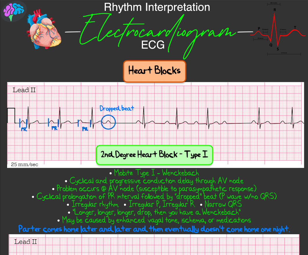 Rhythm Interpretation Notes (PDF)